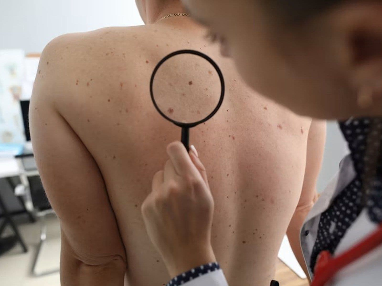 Dermatologie Médicale